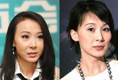 整容失败的明星网红是谁,揭秘那位明星网红的失败整形之路